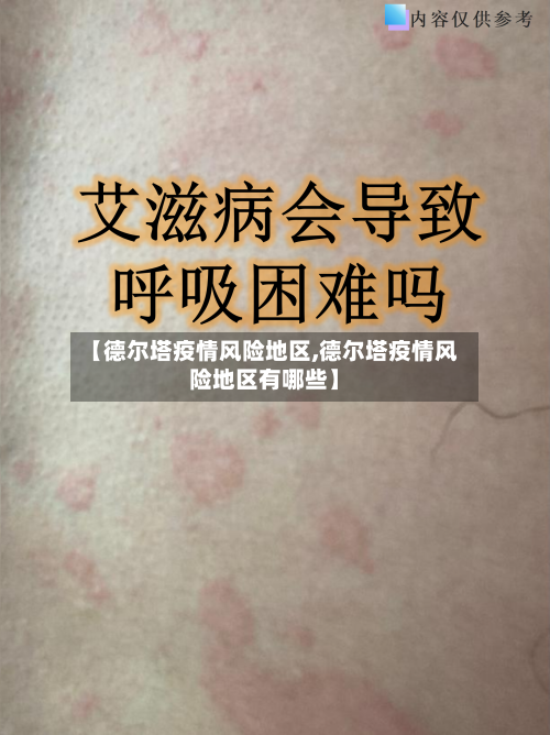 【德尔塔疫情风险地区,德尔塔疫情风险地区有哪些】-第2张图片