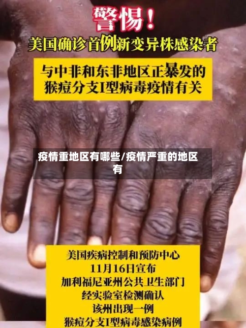 疫情重地区有哪些/疫情严重的地区有