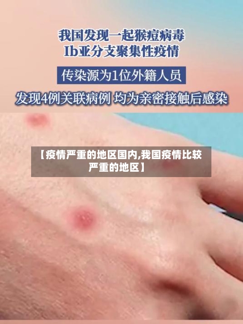 【疫情严重的地区国内,我国疫情比较严重的地区】
