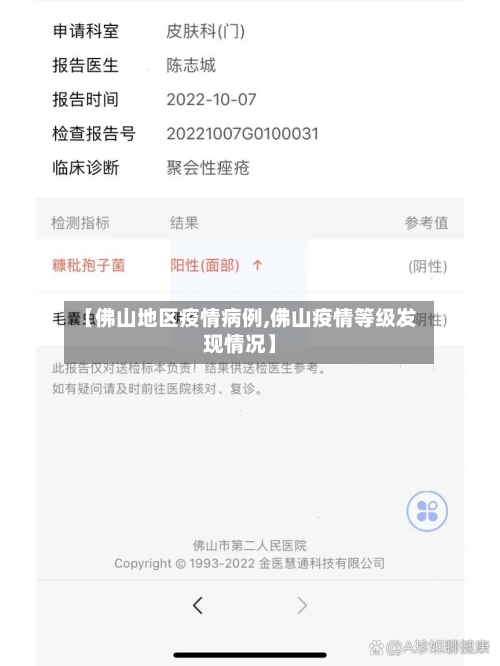 【佛山地区疫情病例,佛山疫情等级发现情况】-第2张图片