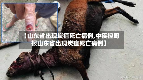 【山东省出现炭疽死亡病例,中疾控周报山东省出现炭疽死亡病例】