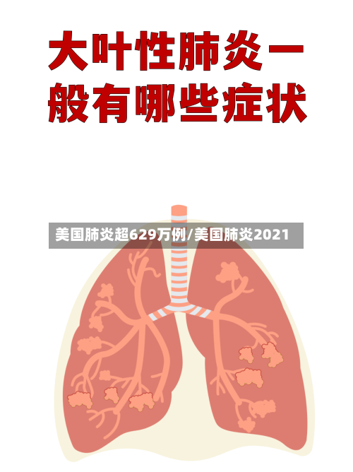 美国肺炎超629万例/美国肺炎2021