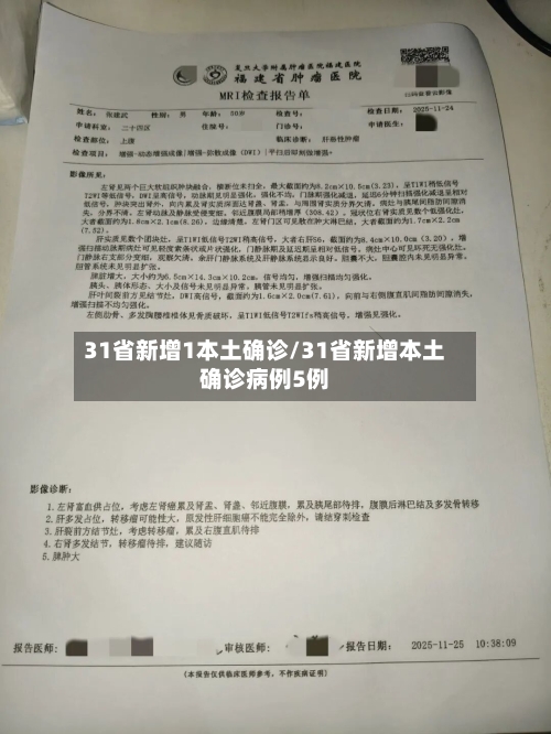 31省新增1本土确诊/31省新增本土确诊病例5例-第3张图片