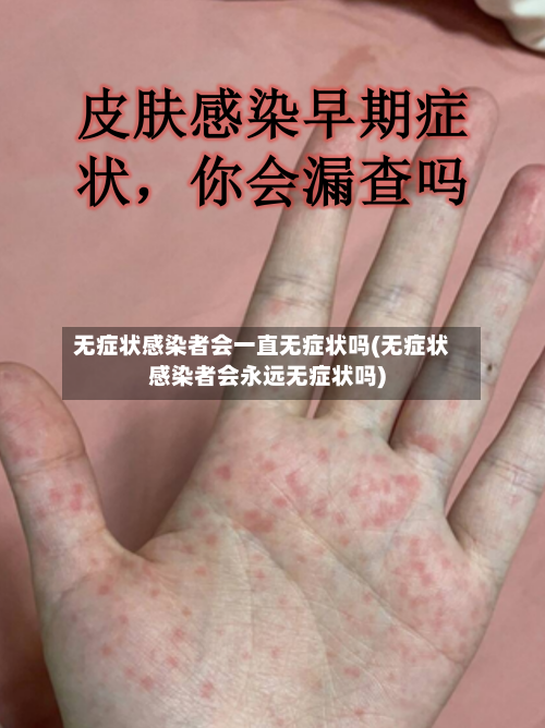 无症状感染者会一直无症状吗(无症状感染者会永远无症状吗)