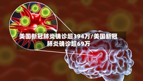 美国新冠肺炎确诊超394万/美国新冠肺炎确诊超69万-第2张图片