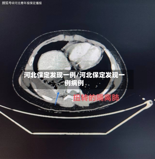 河北保定发现一例/河北保定发现一例病例-第2张图片